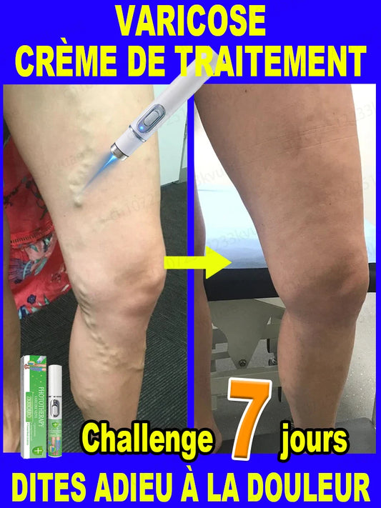 Appareil de Massage Jambes - Soulage Fatigue et Tensions