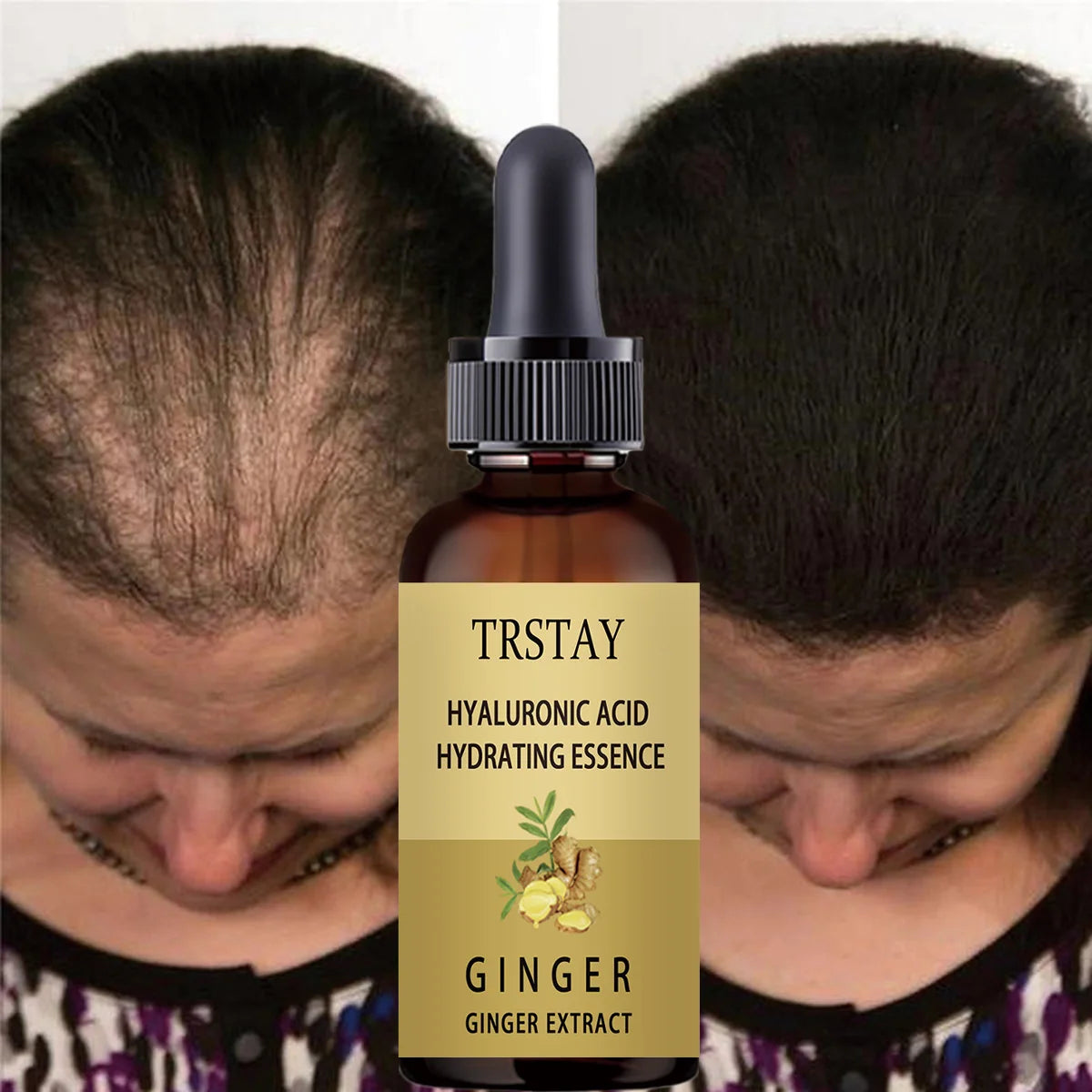 Sérum de Croissance Anti-Chute Alopécie 30ml