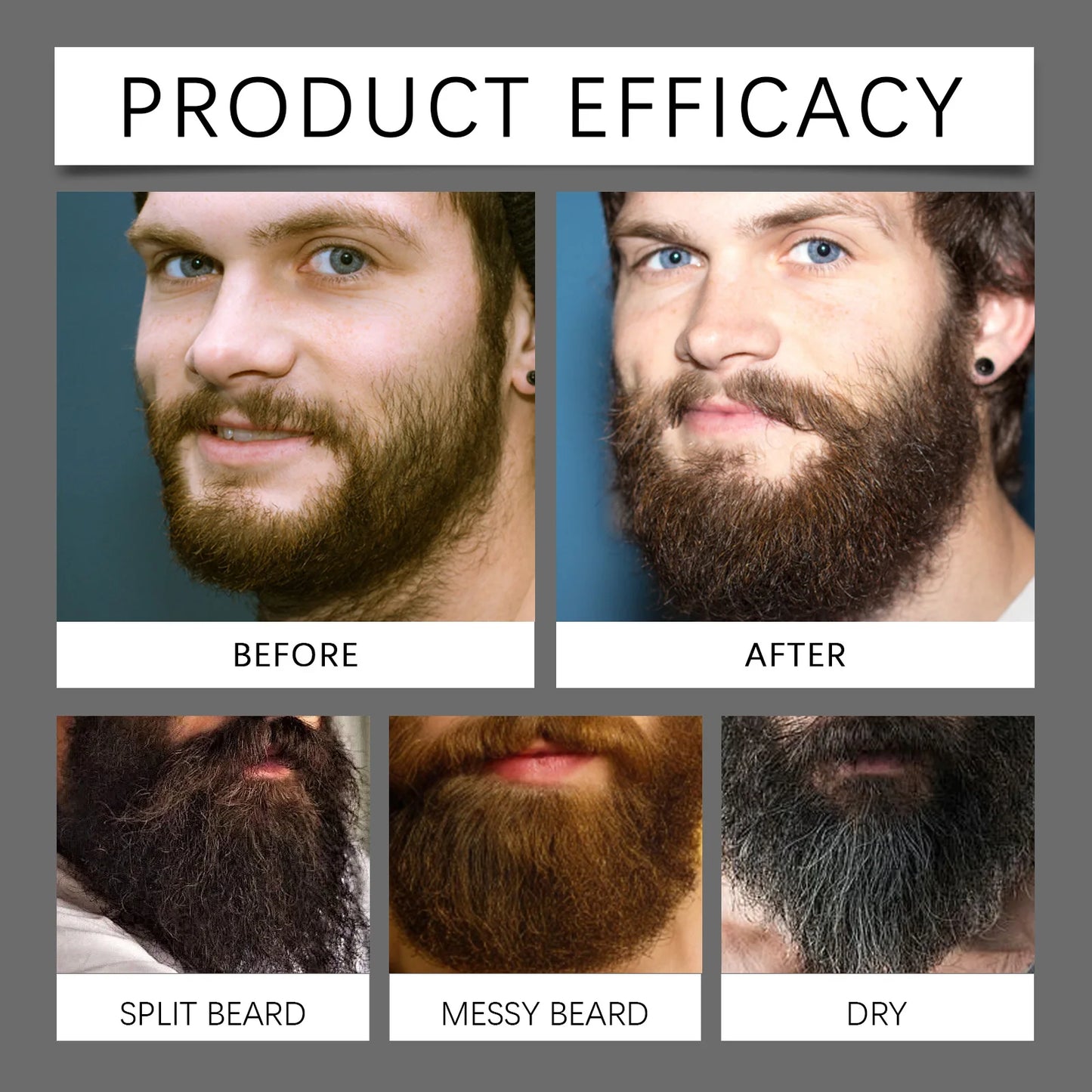 East Moon Beard Growth Serum Set Promotes Whisker Growth Strengthen Hair Roots Soften Skin Moisturizing Hydration Beard Care