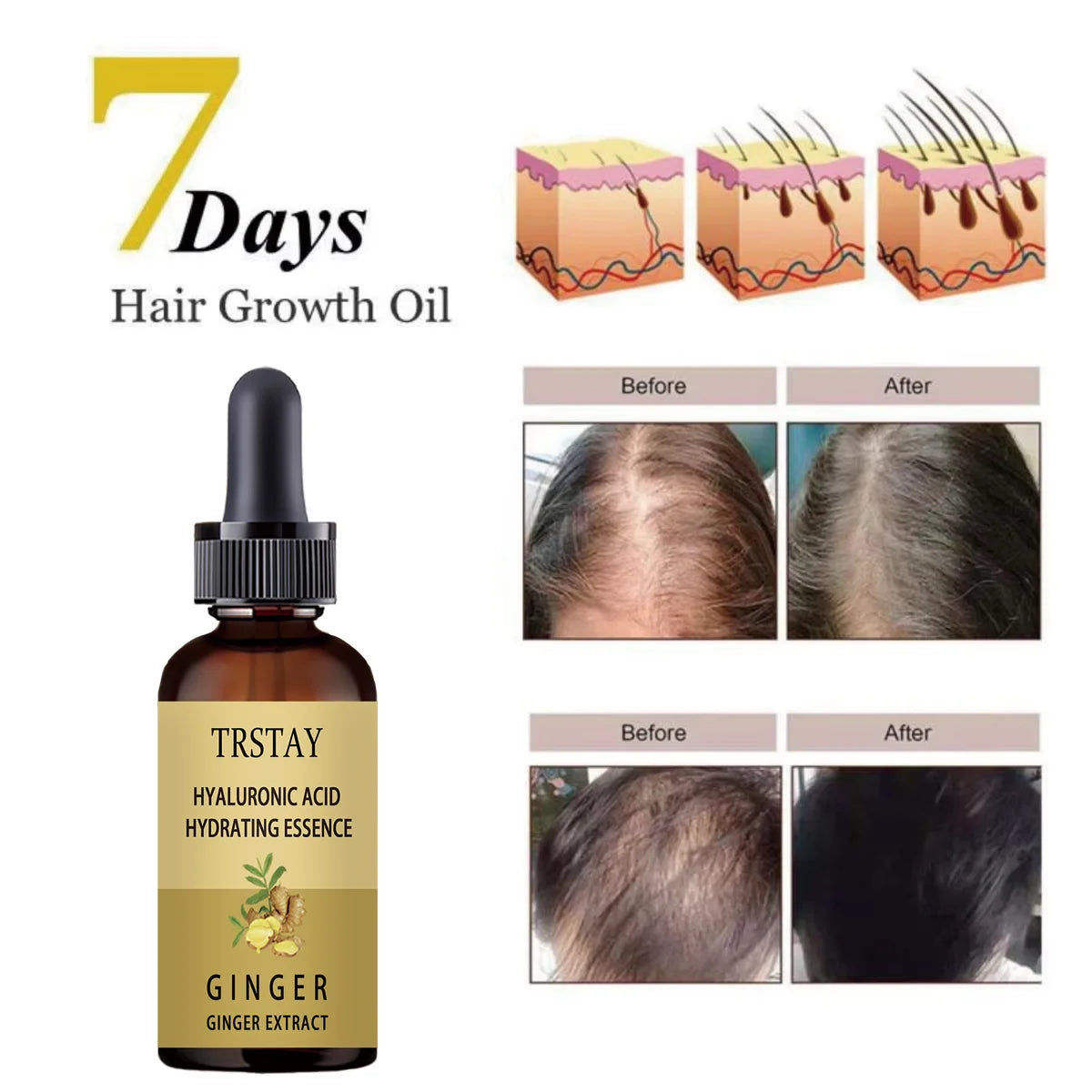 Sérum de Croissance Anti-Chute Alopécie 30ml